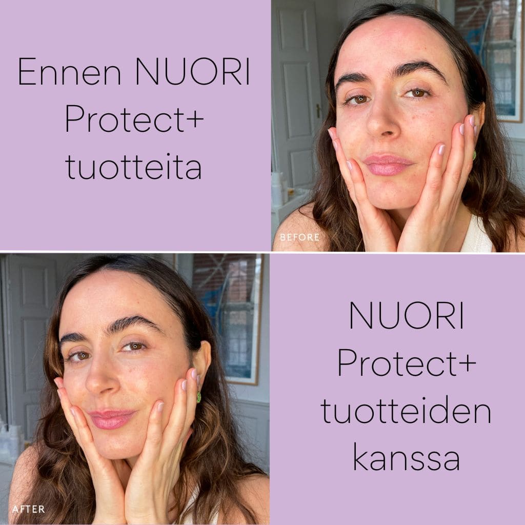 NUORI Protect+ kasvovoide ennen ja jälkeen kuvat
