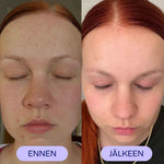 Twistbe Jojoba-teepuu kasvoöljyn käytön ennen ja jälkeen asiakaskuva