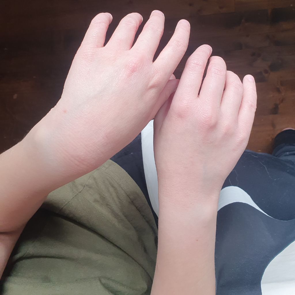 Fiini Naturally Kaura-sheavoi + kaura-kamomilla hoitovesi kombolla saadut tulokset.
