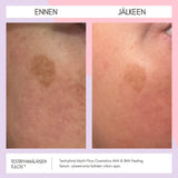 Flow Cosmetics AHA & BHA Peeling seerumi testiryhmän tulokset